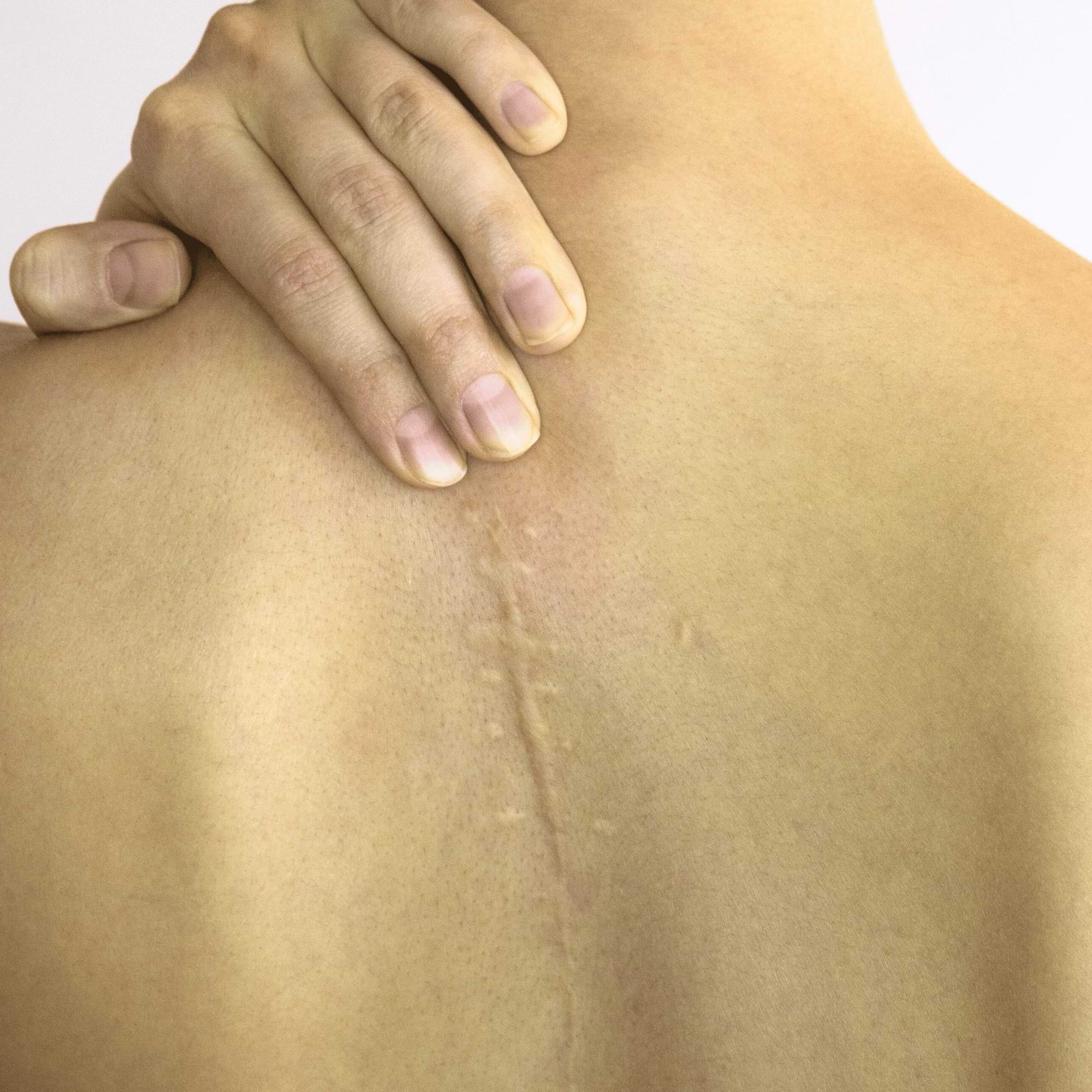 Healed scar running down the spine, gently touched by the person’s hand—marking a journey of recovery.