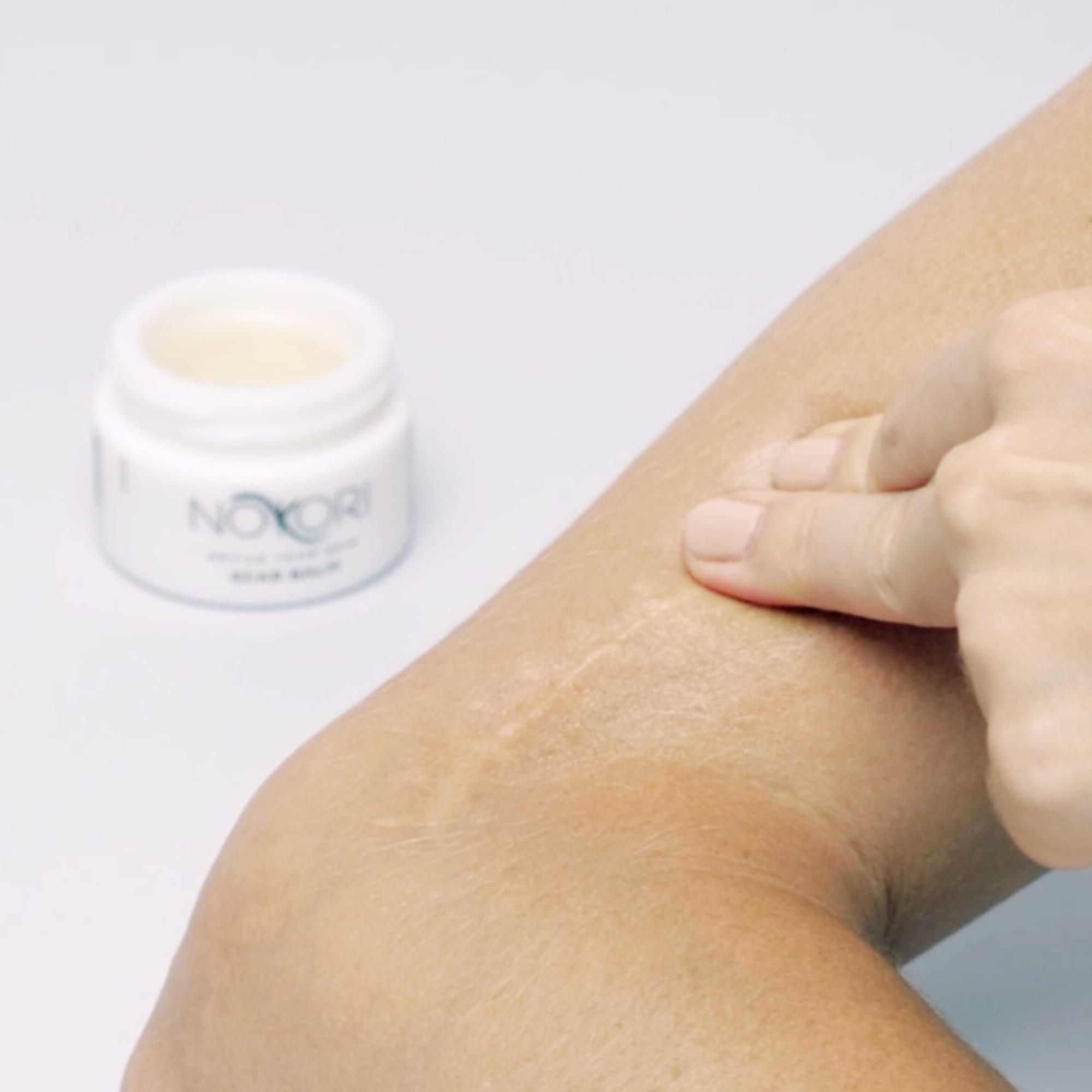 Close-up of Nokori Scar Balm being massaged into a healed scar on the arm, with the product jar in the background