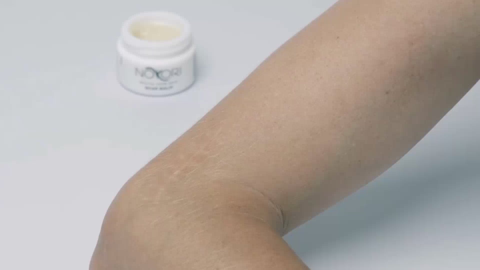 Load video: Close-up of a hand massaging a scar on the elbow, with the Nokori Scar Balm jar softly visible in the background.